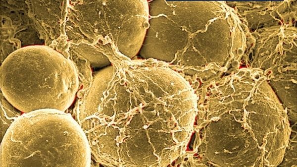 Obesità, tre cause spingono il meccanismo che la rende più grave 