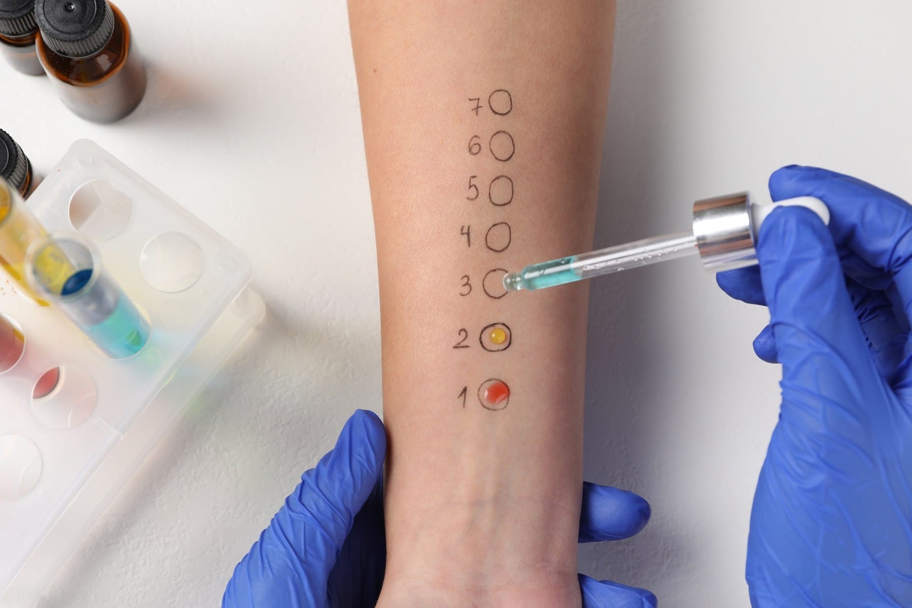 Aprile, dolce… starnutire. Come combattere le allergie della stagione