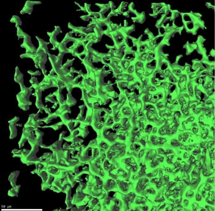 Scoperta l'architettura delle metastasi, è la stessa dell'embrione