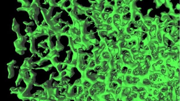 Scoperta l'architettura delle metastasi, è la stessa dell'embrione