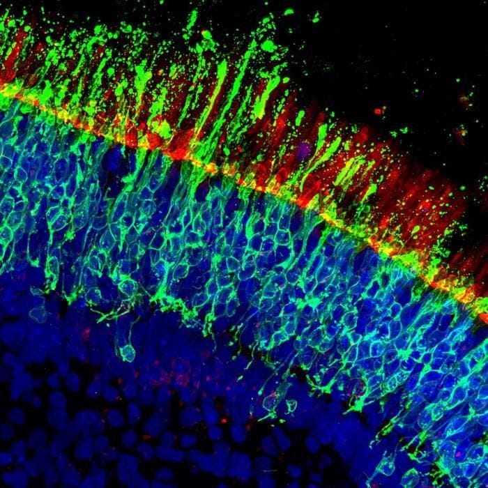 Scoperta una molecola chiave contro la degenerazione maculare