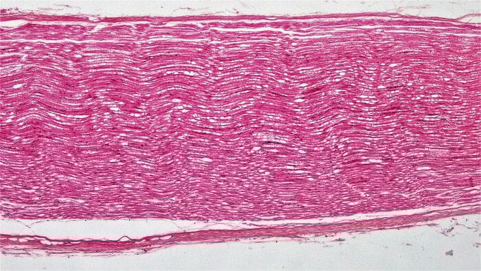 Contro la paralisi, il primo impianto di nervi riprogrammati 