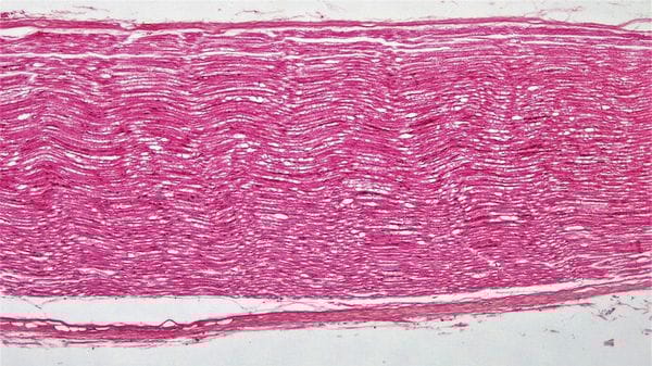 Contro la paralisi, il primo impianto di nervi riprogrammati 