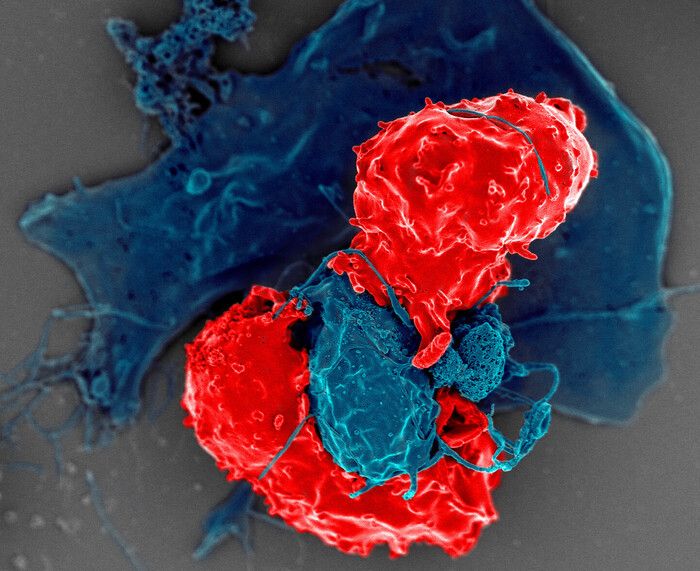 Il sistema immunitario di uomini e donne funziona in modo diverso