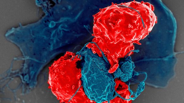 Il sistema immunitario di uomini e donne funziona in modo diverso