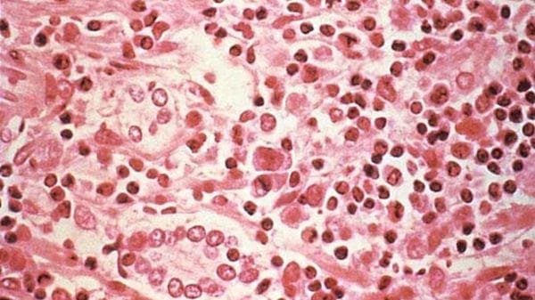 Prima sequenza genetica dell'hantavirus Andes, identica per il 99% rispetto al 2018