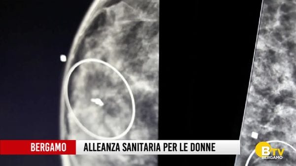 Un'alleanza sanitaria per le donne colpite da tumore della mammella