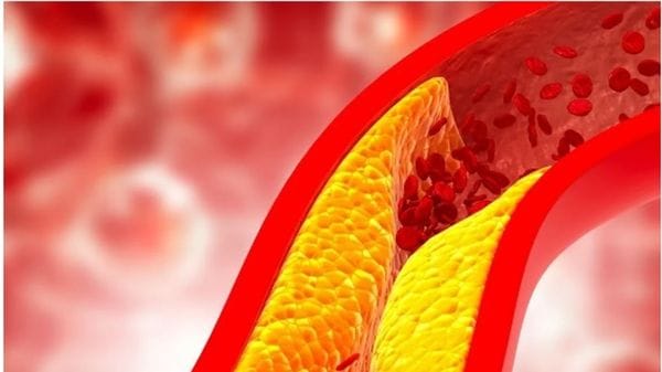 A giugno visite cardiologiche gratis con «Cuore Batticuore»