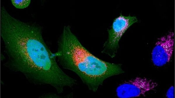 Oltre 1.700 nuove proteine nascoste nel 'proteoma oscuro'