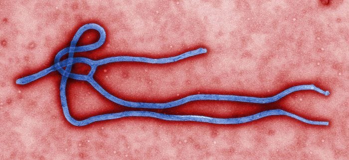 Ebola, i cinque punti cruciali dell'epidemia 