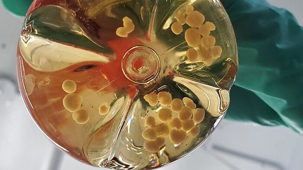 Organoidi di cervello usati per costruire biocomputer 