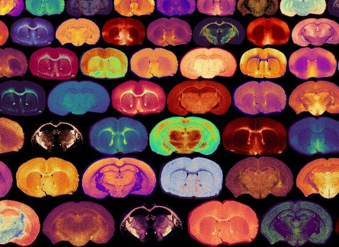 Lo zucchero è due volte amico del cervello, è carburante e segnale chiave