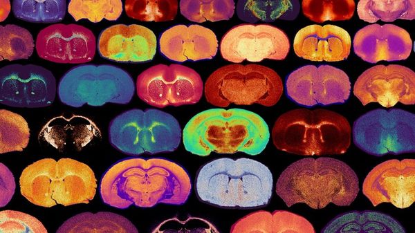Lo zucchero è due volte amico del cervello, è carburante e segnale chiave