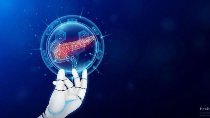 Pancreas artificiale grazie all’IA