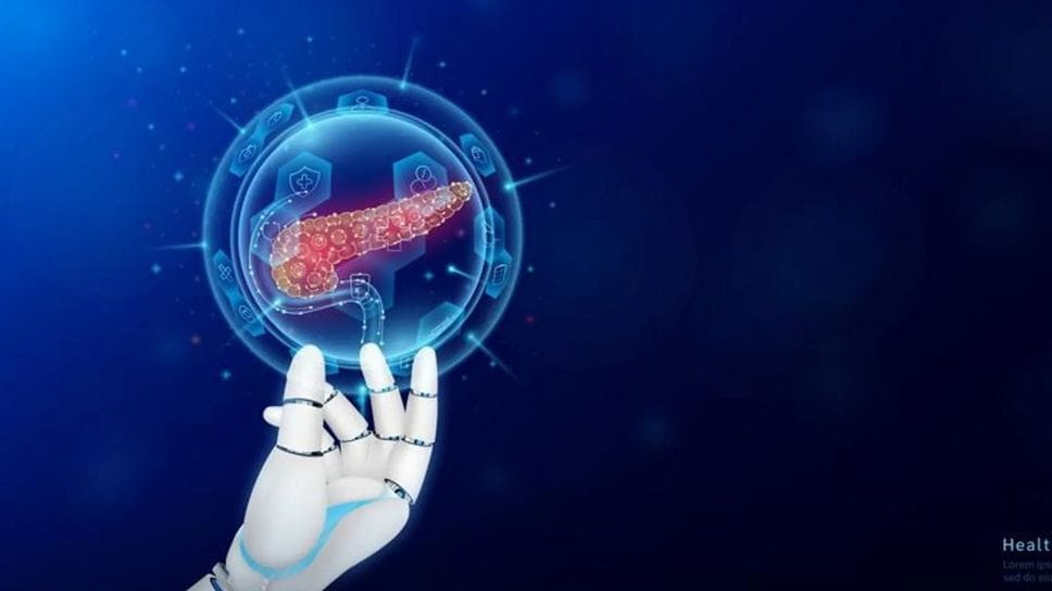 Pancreas artificiale grazie all’IA