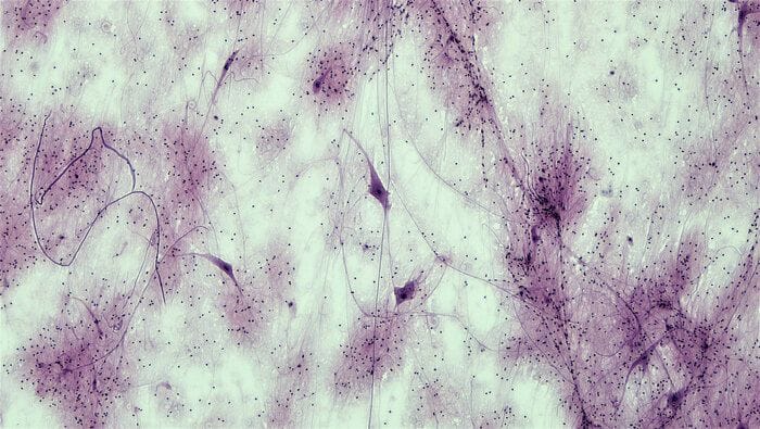 Sla, chiarito il ruolo chiave delle cellule-assistenti dei neuroni 