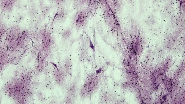 Sla, chiarito il ruolo chiave delle cellule-assistenti dei neuroni 