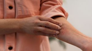 Scoperto l'interruttore del sistema nervoso che spegne il prurito