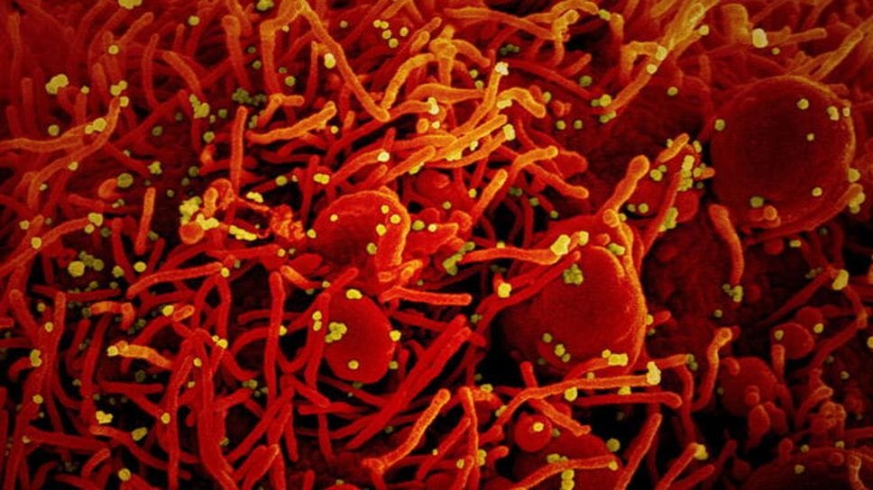 Diagnosi di tumore durante la pandemia: sopravvivenza in calo