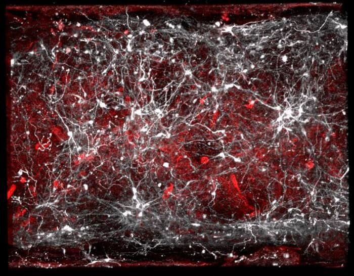 Cervello, la dopamina può alterare il senso di controllo e le decisioni 