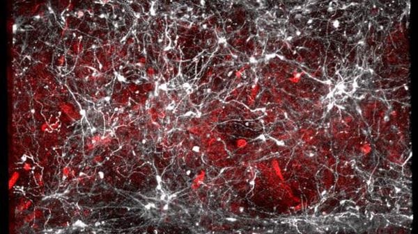 Cervello, la dopamina può alterare il senso di controllo e le decisioni 