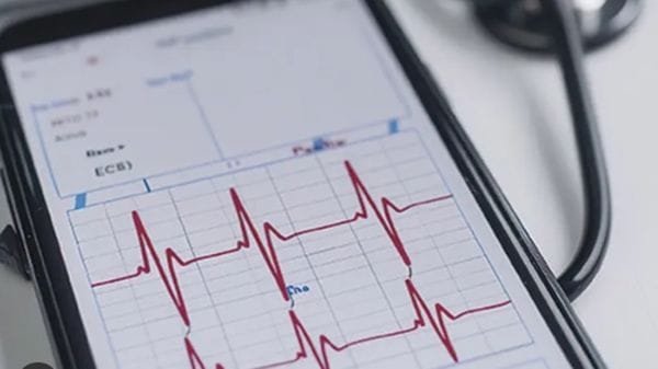 Cuore controllato «a distanza» con l’IA per 100mila italiani