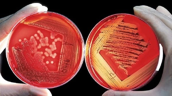 Una malattia autoimmune in remissione da 15 anni, grazie alle staminali 