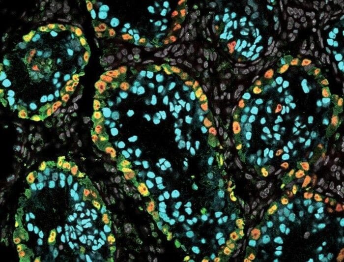 Dalle cellule staminali i primi spermatozoi umani coltivati in laboratorio 