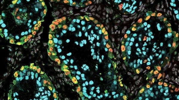 Dalle cellule staminali i primi spermatozoi umani coltivati in laboratorio 