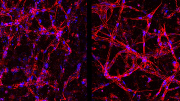 Retina, cellule vascolari ottenute in laboratorio per nuove terapie