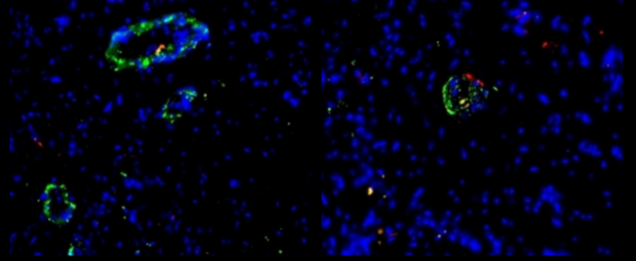 Organoidi di vasi sanguigni, sul cuore come cerotti