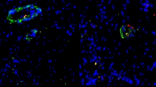 Organoidi di vasi sanguigni, sul cuore come cerotti