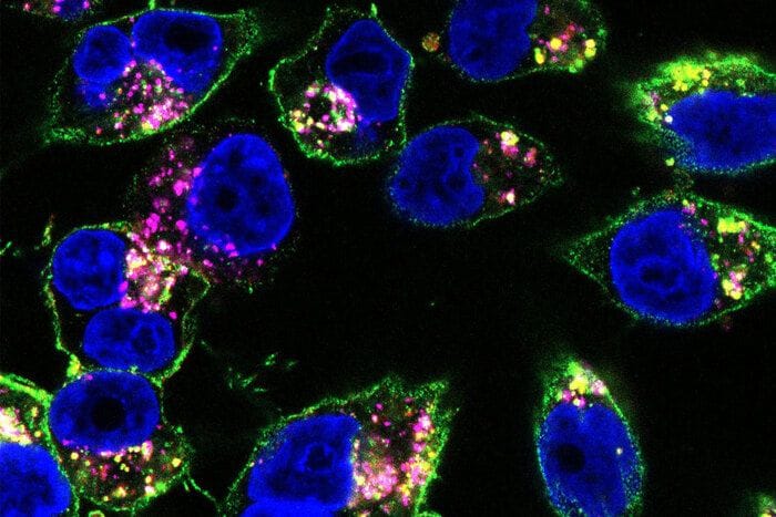 Da un farmaco mutaforma un doppio colpo ai tumori