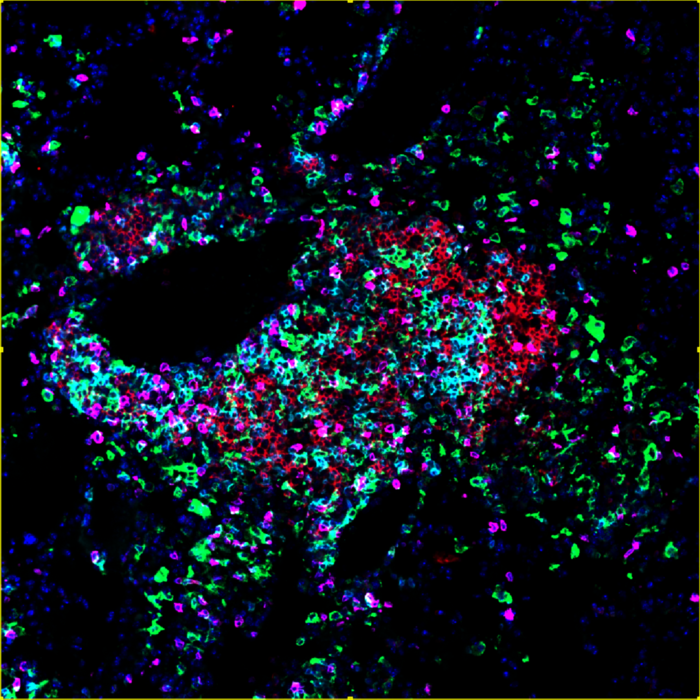 Identificate le cellule che costruiscono gli avamposti anticancro