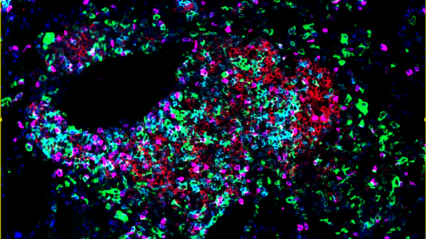 Identificate le cellule che costruiscono gli avamposti anticancro