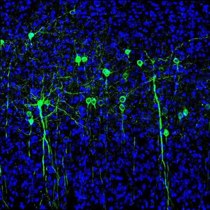 Nel cervello prevalgono i neuroni tuttofare 