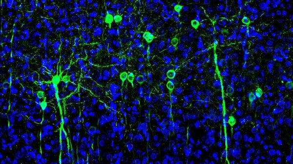 Nel cervello prevalgono i neuroni tuttofare 