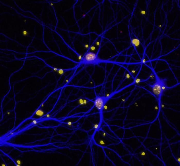 Un farmaco contro le lesioni spinali efficace anche contro l'Alzheimer