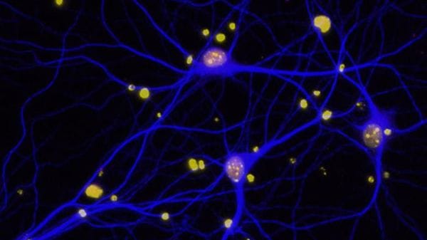 Un farmaco contro le lesioni spinali efficace anche contro l'Alzheimer
