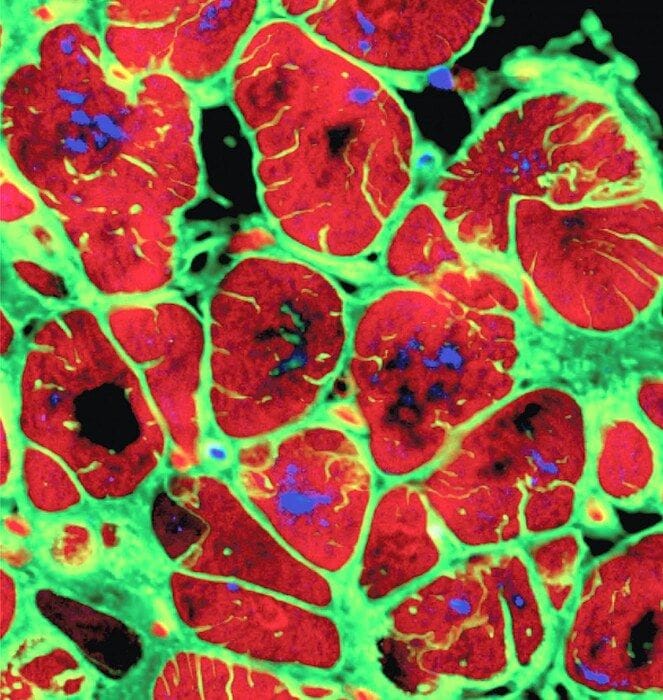 Il cuore ha un piccolo 'cervello' che lo protegge dallo stress 