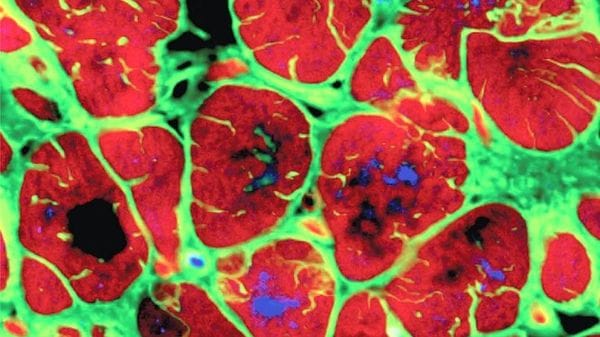 Il cuore ha un piccolo 'cervello' che lo protegge dallo stress 