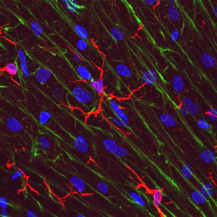 Fra i 50 e i 75 anni il cervello cambia, perde cellule immunitarie 
