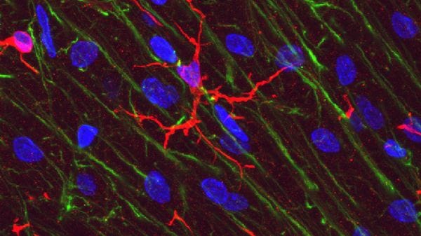 Fra i 50 e i 75 anni il cervello cambia, perde cellule immunitarie 