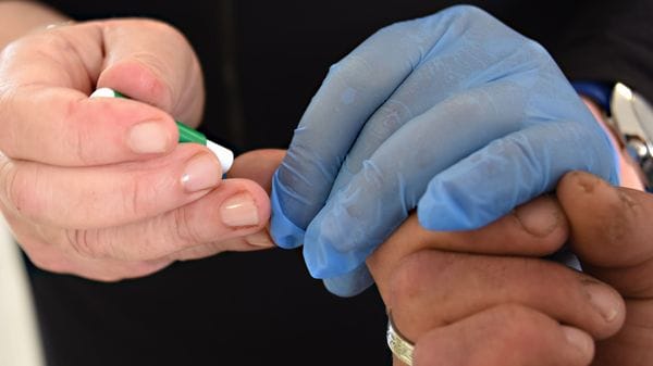 Hiv, test rapidi in 40 farmacie