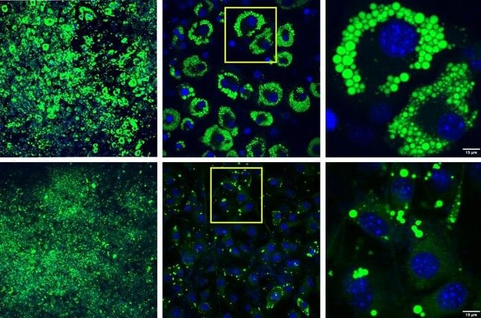 Individuata una proteina che accelera il metabolismo dei grassi