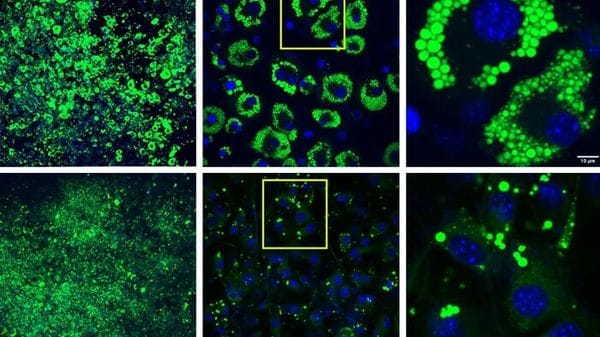 Individuata una proteina che accelera il metabolismo dei grassi