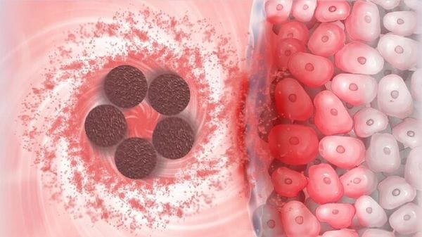 Microalghe-robot diventano armi contro il tumore alla vescica