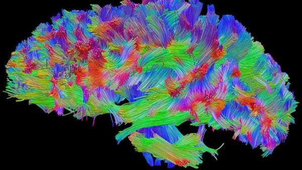 Lo stress vissuto nell'infanzia lascia cicatrici nel cervello 