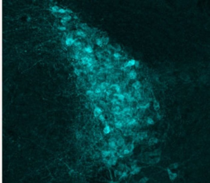 Scoperto nel cervello il freno che può bloccare il dolore cronico 