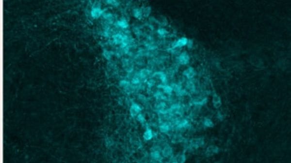 Scoperto nel cervello il freno che può bloccare il dolore cronico 